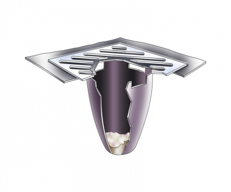 ut 9217 gallery3 drain guard installing